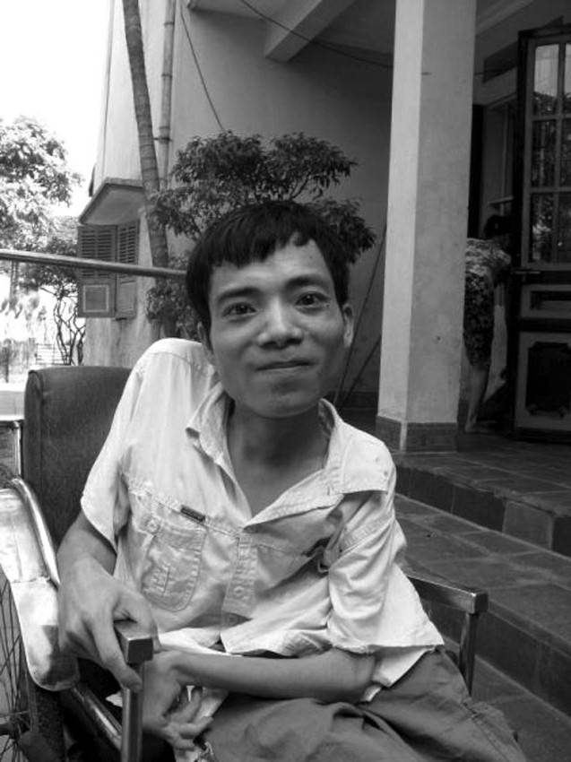 Una de las víctimas de los más de 80 millones de litros de agente naranja vertidos por las fuerzas aéreas de Estados Unidos sobre el sur de Vietnam desde 1961 a 1971. La imagen forma parte de una exposición fotográfica inaugurada en Ho Chi Minh City. 