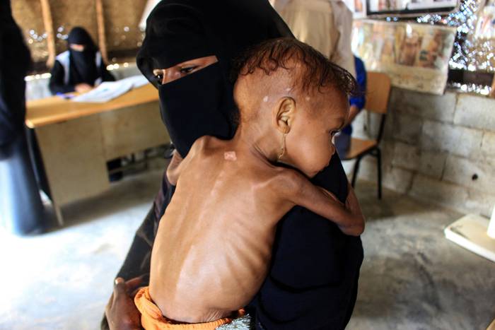 Randa, bebé yemení con su madre en un centro de salud administrado por una organización humanitaria, el  22 de diciembre de 2021, en la provincia noroccidental de Hajjah, Yemen. · Foto: Essa Ahmed, AFP