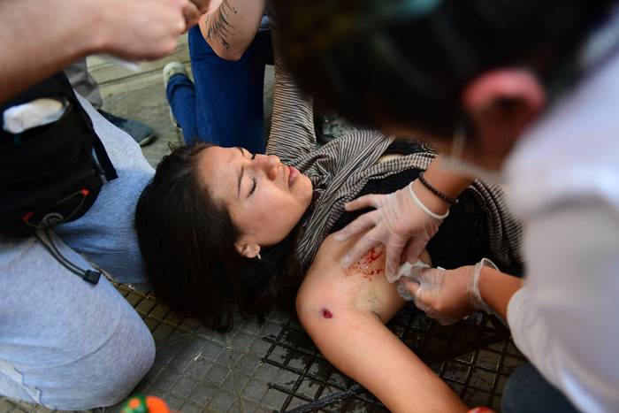 Una mujer recibe asistencia después de recibir un disparo con una bala de goma, durante los enfrentamientos con la policía antidisturbios. · Foto: Martín Bernetti, AFP