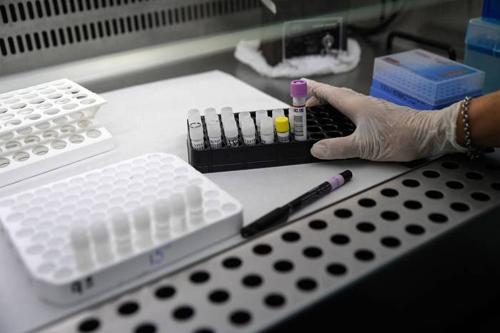 Realización de pruebas de reacción en cadena de la polimerasa (PCR), en el laboratorio de microbiología del Hospital Ramón y Cajal, el 14 de abril, en Madrid. · Foto: Óscar del Pozo, AFP