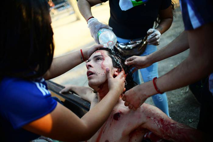 Un manifestante es asistido luego de ser herido por Carabineros, el 3 de noviembre, en Santiago. · Foto: Rodrigo Arangua, AFP
