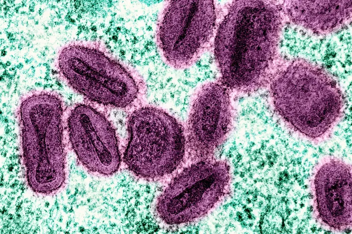 Virus Mpox. Foto: NIAD