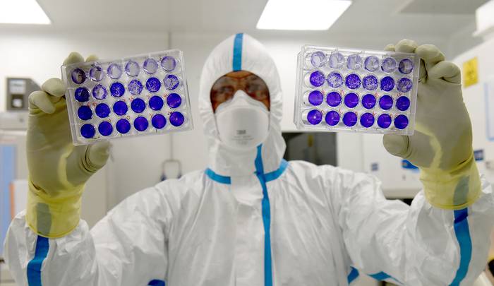 El ingeniero y virólogo francés Thomas Mollet analiza células adherentes infectadas con un virus Sars-CoV-2 en el laboratorio de Bioseguridad del Grupo Valneva SE en Saint-Herblain, en Nantes, Francia, el 30 de julio.
 · Foto: Jean-Francois Monier, AFP