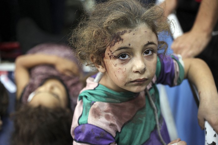 Niña que resultó herida durante una operación israelí, el 21 de octubre, en el campo de refugiados de Jabalia, en el centro de la Franja de Gaza. · Foto: Omar Al-Qattaa, AFP