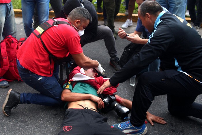 El fotoperiodista argentino Pablo Grillo recibe atención médica tras resultar herido durante una protesta de jubilados, apoyada por hinchas de fútbol, contra el gobierno de Javier Milei, el 12 de marzo, en Buenos Aires. · Foto: Nicolás Suárez, AFP