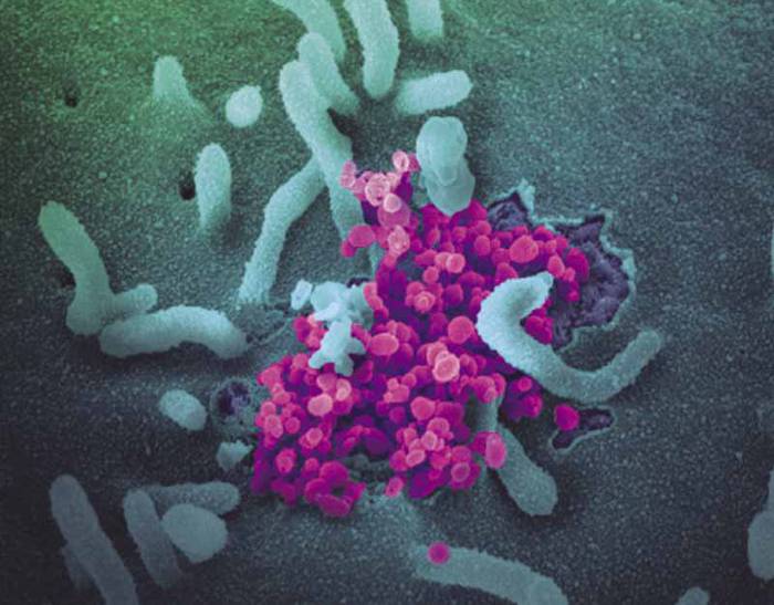 Imagen de microscopio electrónico de barrido de una muestra de SARS-CoV-2, objetos redondos magenta, que emerge de la superficie de células cultivadas en el laboratorio. Foto: National Institute of Allergy and Infectious Diseases (NIAID).