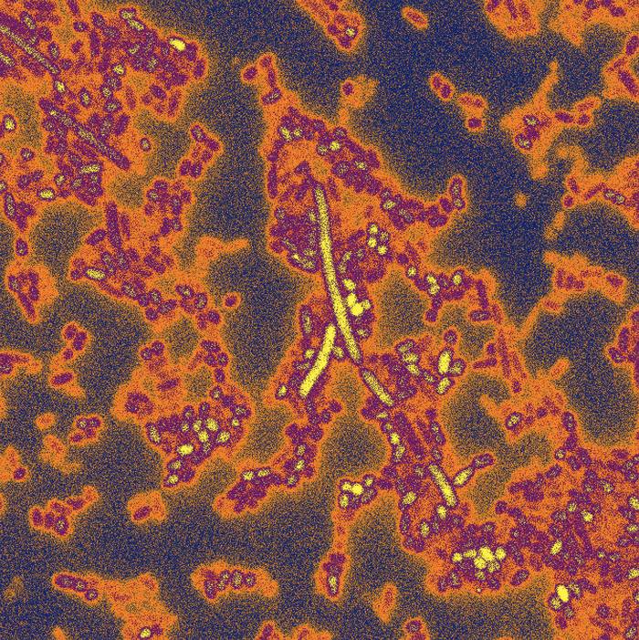 Bacteroides del intestino.
Foto de Kevin Cutler (Mougous Lab, University of Washington, School of Medicine)