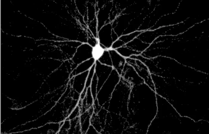 Neurona. Foto: Mitali Tyagi