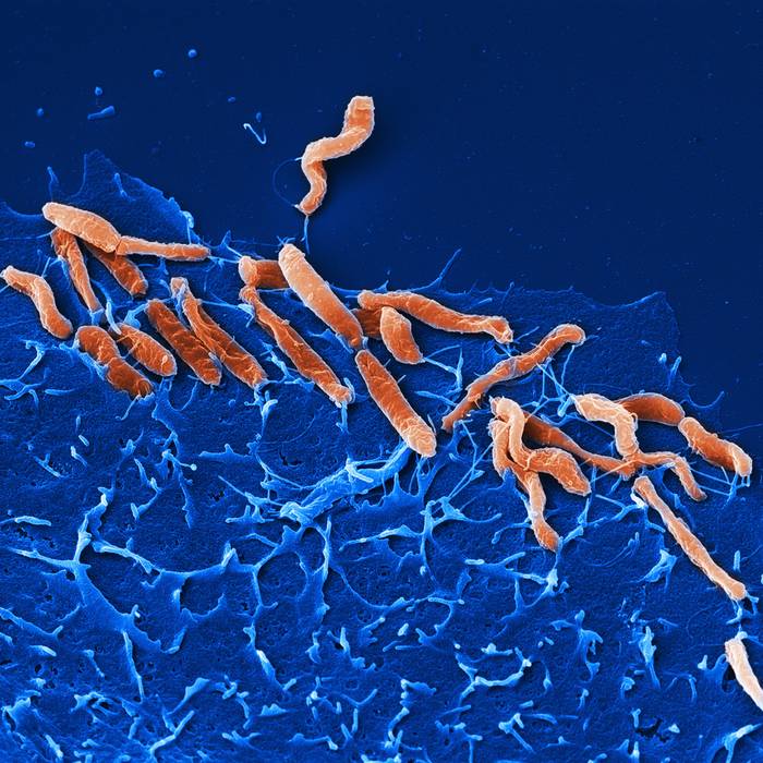 _Helicobacter pylori_. Imagen: M. Rohde -HZI.