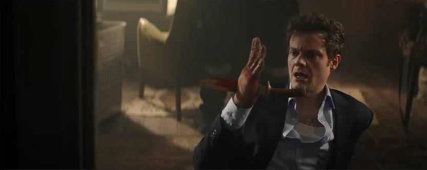 32 20251017 Novocaine