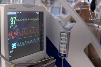 CTI del Hospital de Clínicas (archivo, febrero de 2025). · Foto: Ernesto Ryan