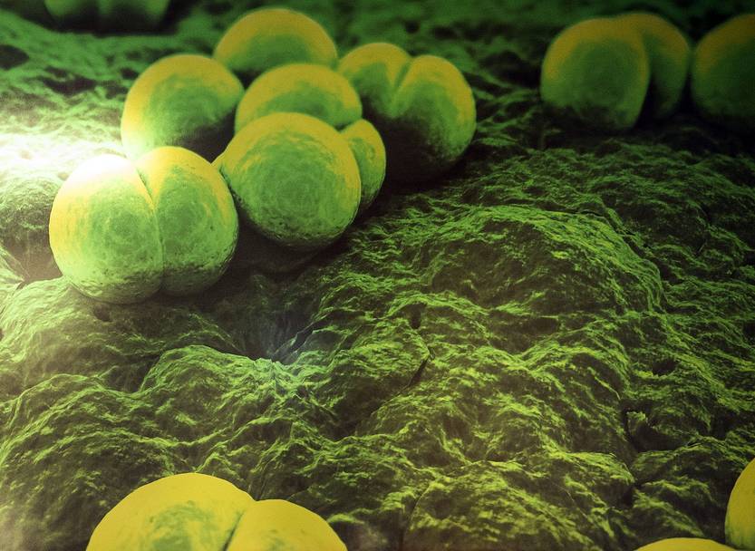 Streptococcus