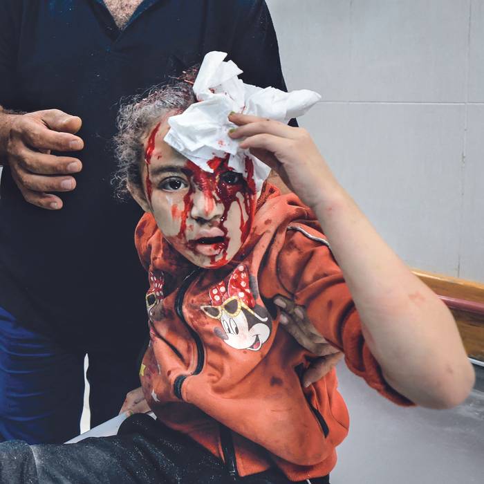 Hospital Al-Nasr, tras el bombardeo israelí en Khan Yunis, en el sur de la Franja de Gaza, el 26 de octubre. · Foto: Mahmud Hams,  AFP