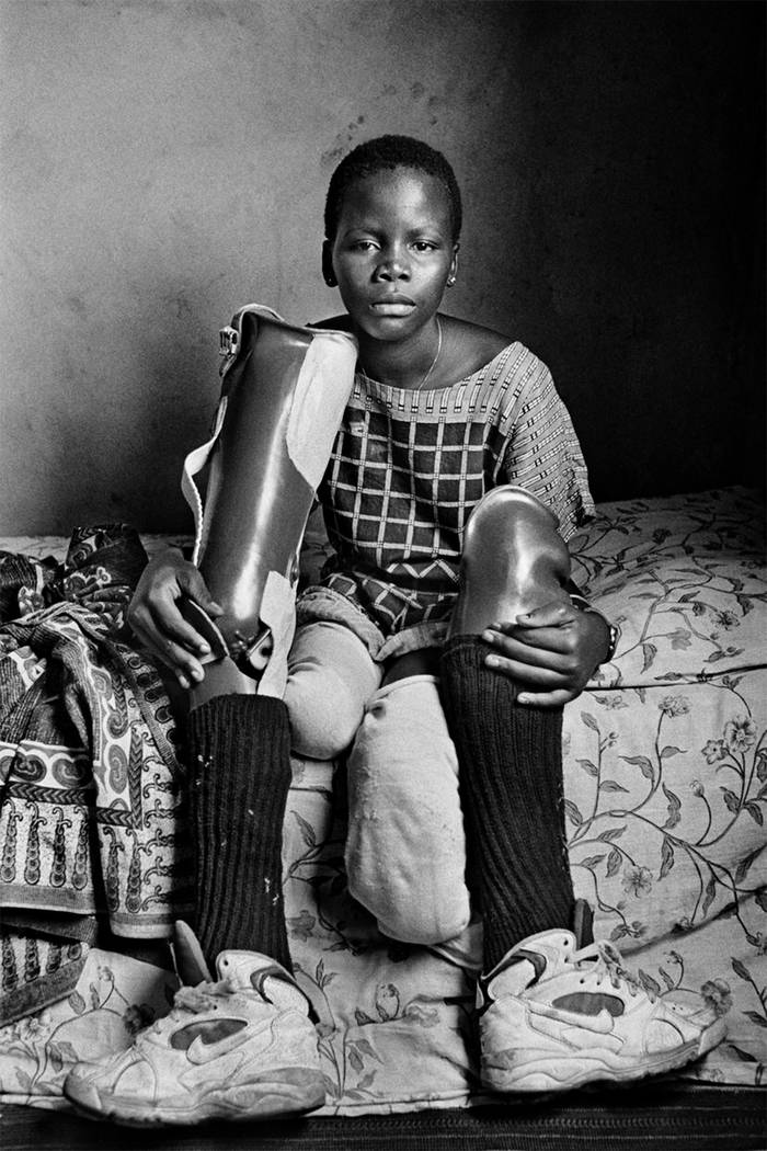 Sofia en 1997, más de tres años después de la explosión, con sus prótesis. La foto forma par te del libro Vidas Minadas. 25 años (Blume). · Foto: Gervasio Sánchez