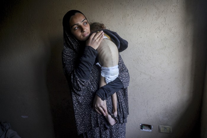 Una madre palestina sostiene a su hija que sufre desnutrición, en un refugio donde viven después de ser desplazadas por la guerra, en Deir el-Balah, en el centro de la Franja de Gaza, el 24 de diciembre de 2024. · Foto: Eyad Baba, AFP