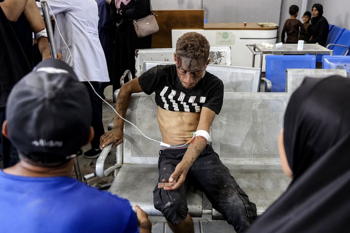 Hospital Al-Shifa, el 14 de junio en Gaza. · Foto: Omar Al-Qattaa, AFP