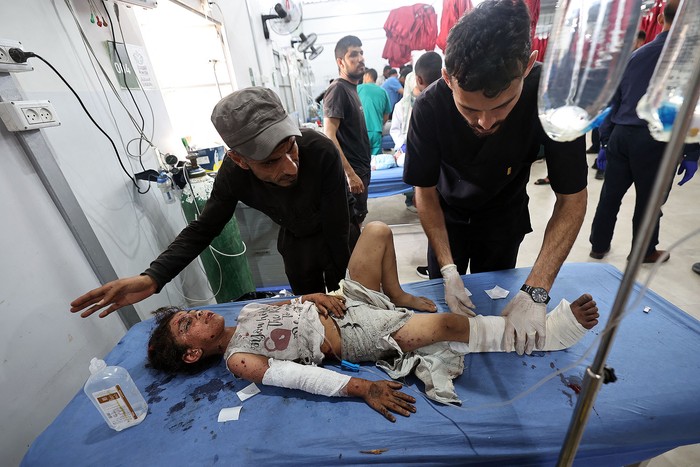 Una niña herida, el 19 de mayo, en el Hospital Al-Awda, tras un ataque aéreo israelí que impactó una escuela que albergaba a palestinos desplazados. · Foto: Eyad Baba, AFP