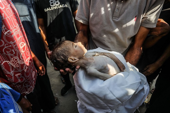 El cuerpo desnutrido de Yahya al-Najjar, de 4 meses, quien falleció por desnutrición severa, el 20 de julio, en Khan Yunis, Gaza. · Foto: Abed Rahim Khatib, Anadolu, AFP
