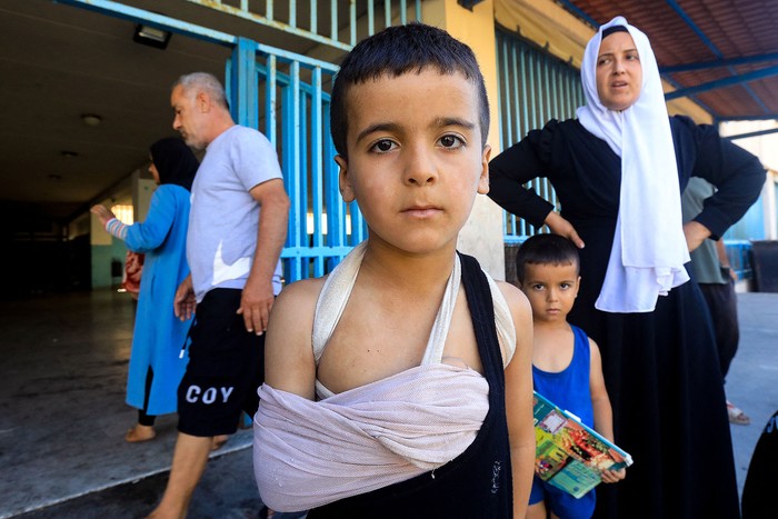 Un niño herido posa en una escuela de Beirut que alberga a desplazados que huyeron de los ataques israelíes, ayer, en el sur del Líbano. · Foto: AFP