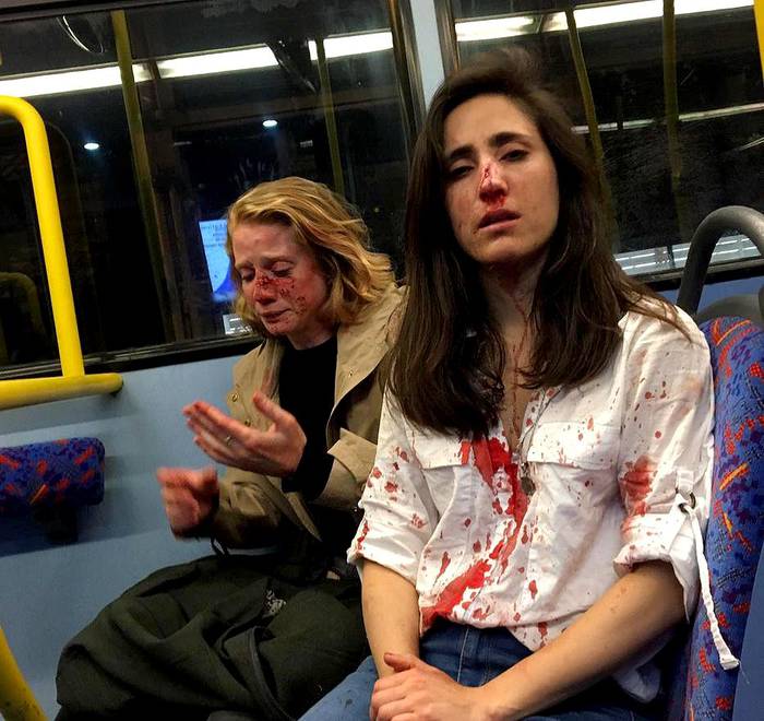 Melania Geymonat (der.) y su novia Chris tras el ataque que sufrieron en un ómnibus de Londres. Foto: Melania Geymonat
