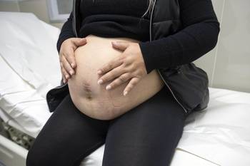 Hospital Pereira Rossell. · Foto: Alessandro Maradei