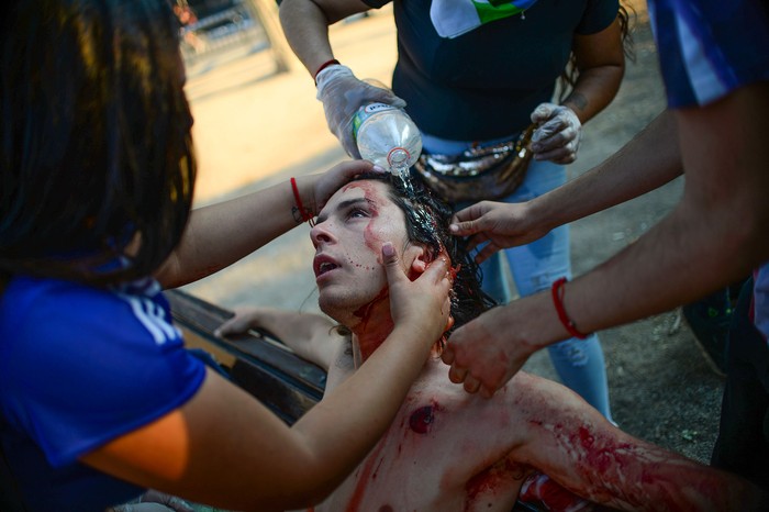 Un manifestante herido recibe asistencia, durante una protesta contra el gobierno del presidente Sebastián Piñera, en Santiago de Chile. · Foto: Rodrigo Arangua, AFP