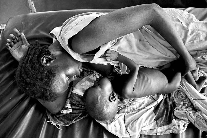 Una madre con su hijo que sufre desnutrición aguda, en una clínica en Aweil, Sudán del Sur, el 11 de octubre de 2016. Foto: Albert González Farran, AFP