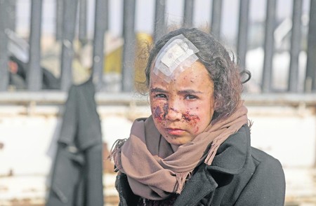 Niña herida huye del grupo Estado Islámico, durante una operación realizada por las Fuerzas de Siria Democrática, en la provincia oriental de Deir Ezzor. Foto: Delil Souleiman, AFP Niña herida huye del grupo Estado Islámico, durante una operación realizada por las Fuerzas de Siria Democrática, en la provincia oriental de Deir Ezzor. Foto: Delil Souleiman, AFP
