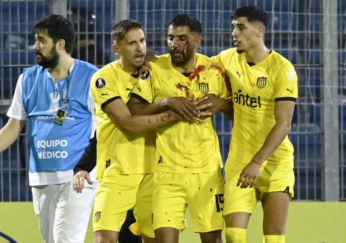 Maximiliano Olivera (c) es asistido por compañeros de Peñarol durante el partido con Rosario Central en el estadio Gigante de Arroyito, en Rosario, Argentina (archivo, abril de 2024). · Foto: Marcelo Manera, AFP