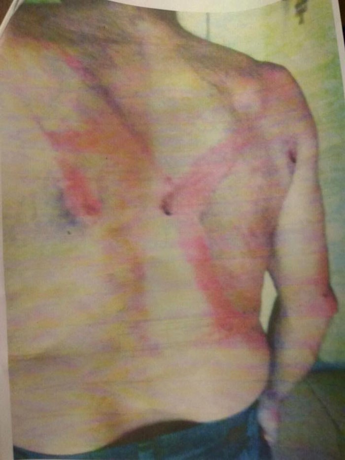 Hugo Antonio Leites, trabajador rural, luego de ser agredido. Foto: s/d autor
